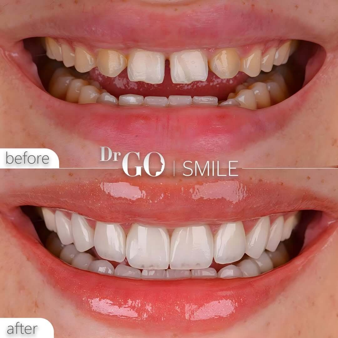 SaveClip.App_519976565_17964565340933272_9152657135012076631_n